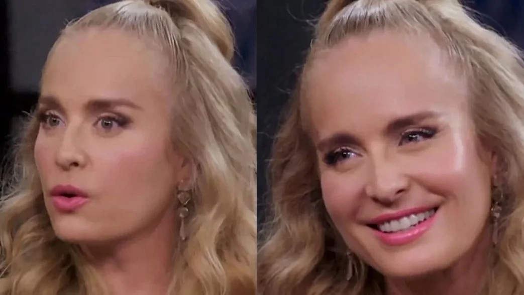 Angélica Desabafa Sobre Harmonização Facial