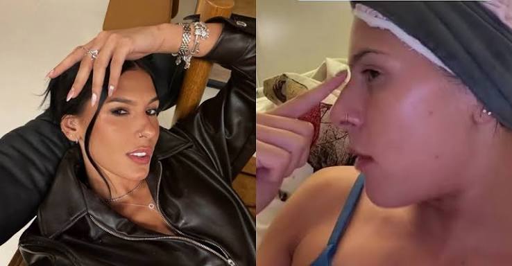 ANA CASTELA ABRE O JOGO SOBRE ESTÉTICA!