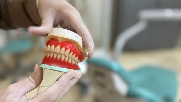 MOGI GUAÇU | MUTIRÃO VAI ENTREGAR 30 PRÓTESES DENTÁRIAS PELO SUS